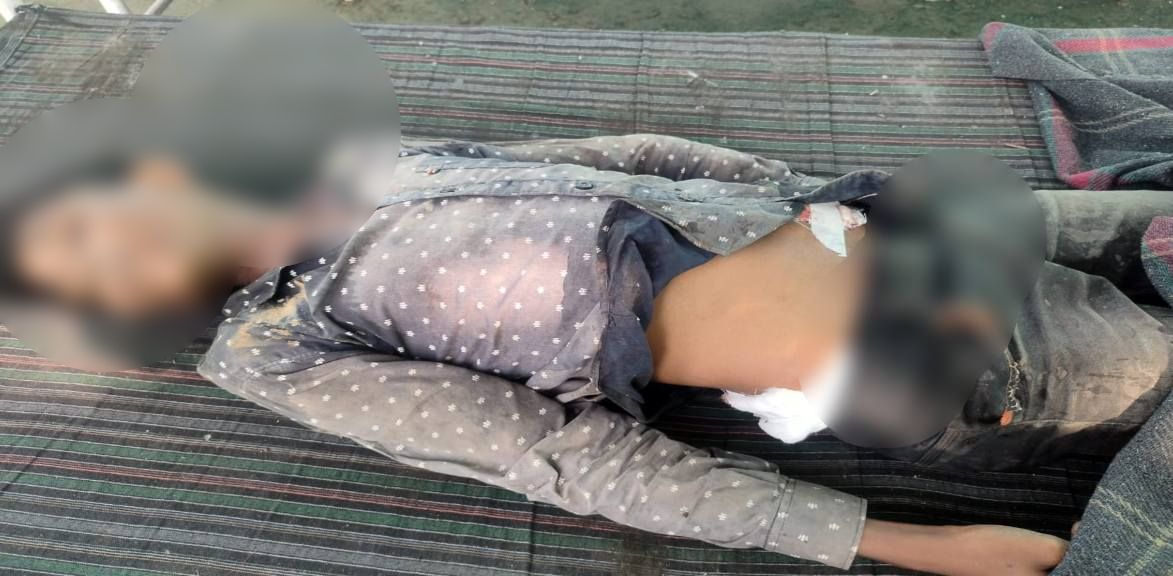 MP News: रायसेन में नाबालिग आदिवासी बच्चे की गोली लगने से मौत, पिता ने हत्या का लगाया आरोप