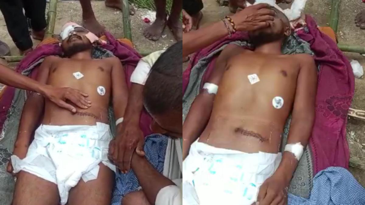 श्मशान घाट में मुर्दा उठा ले गई पुलिस: अस्पताल प्रबंधन पर किडनी चोरी का लगा आरोप, अब पोस्टमार्टम के बाद खुलेगा राज