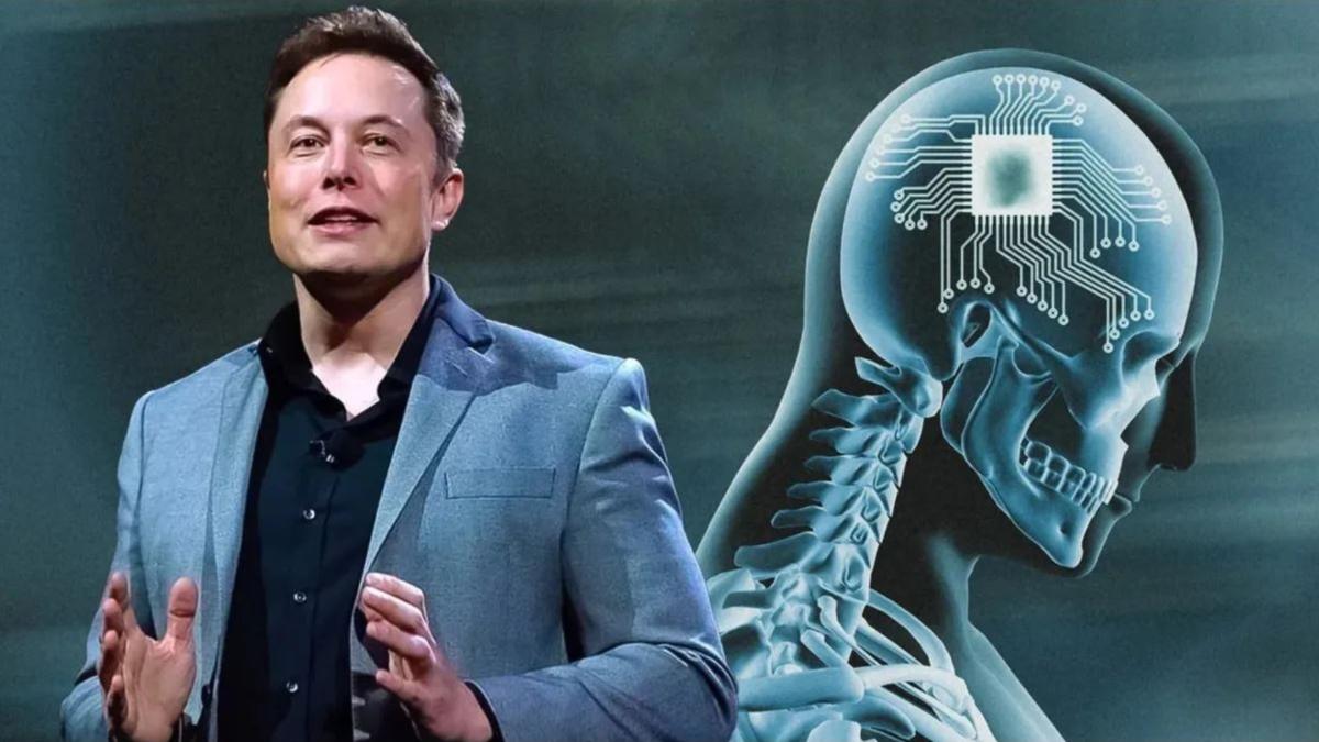 अमेरिका ने Elon Musk के स्टार्टअप को दी मंजूरी, इंसानी दिमाग में लगेगी Neuralink की चिप, हजारों लोग हुए तैयार