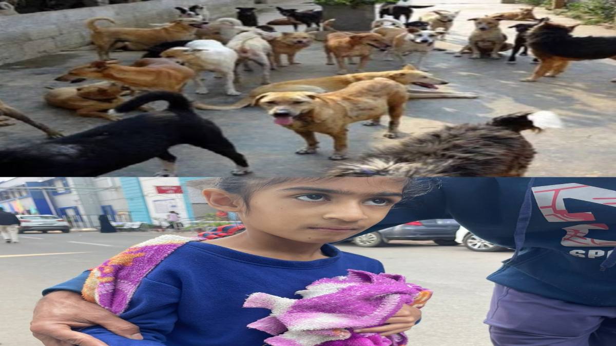 भोपाल में कुत्तों का आतंक जारी: मासूम बच्ची के हाथ को नोचा, अस्पताल में रेबीज के इंजेक्शन के लिए लंबी कतार