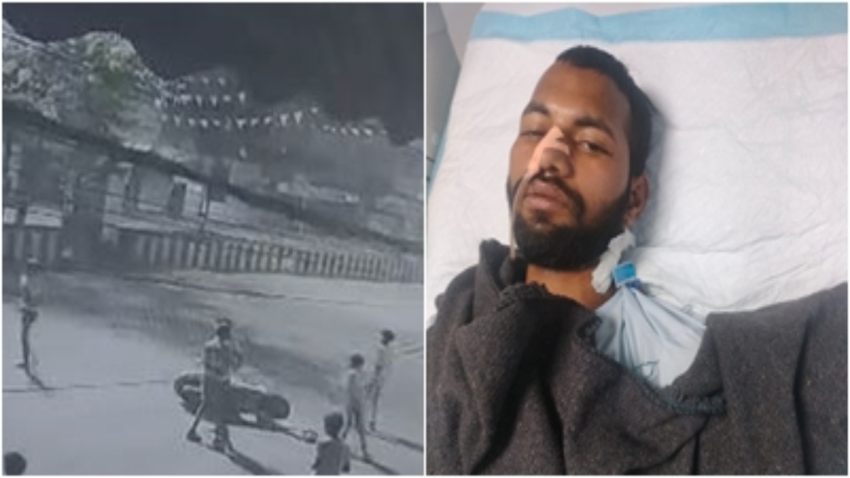बदमाशों ने युवक पर चाकू से किया जानलेवा हमला: अस्पताल में भर्ती, वारदात CCTV कैमरे में कैद 