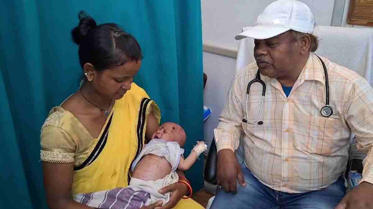 अंधविश्वास : इलाज के नाम पर 18 दिन की बच्ची के शरीर को गरम सलाखों से दागा, हालत बिगड़ी तो अस्पताल में कराया भर्ती