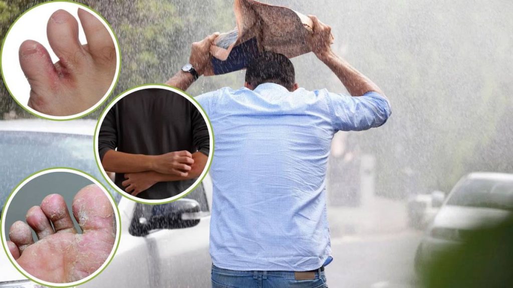 Monsoon Fungal Infection Prevention