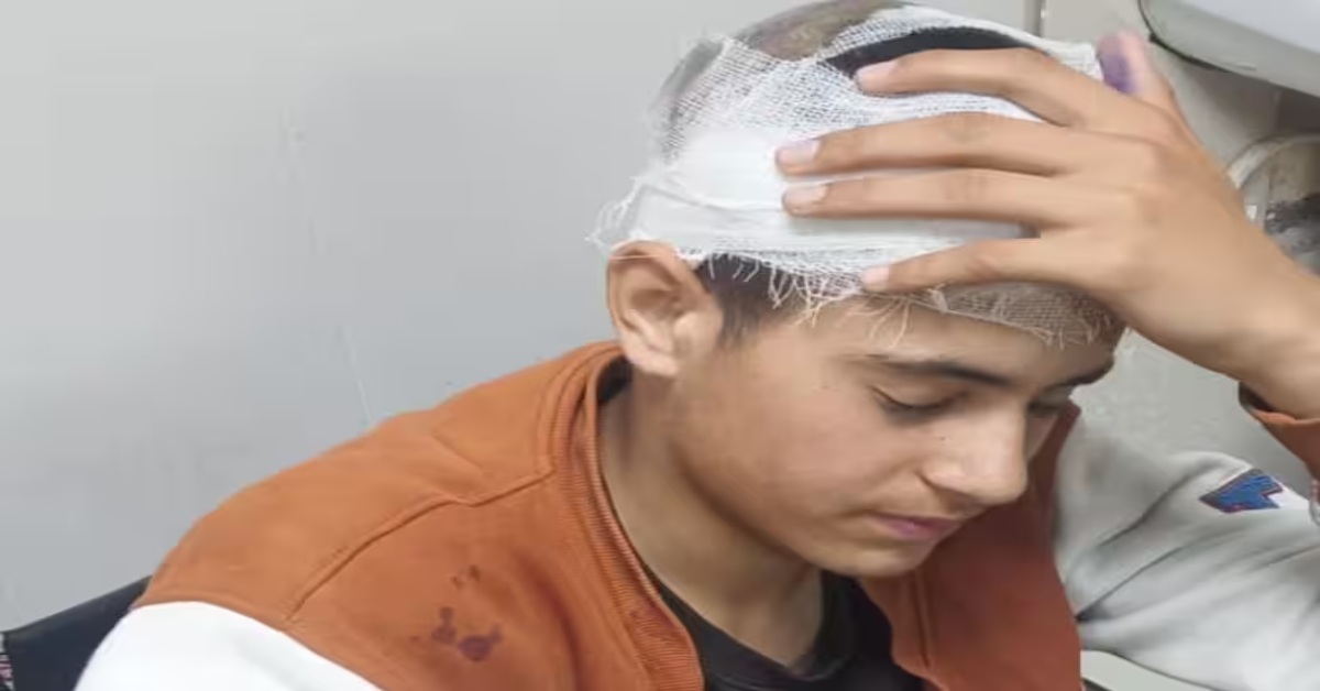 यहां दूसरे राज्य का नागरिक सुरक्षित नहीं? उत्तराखंड में कश्मीरी युवक पर जानलेवा हमला, रॉड से किया गया वार, हाथ फ्रैक्चर