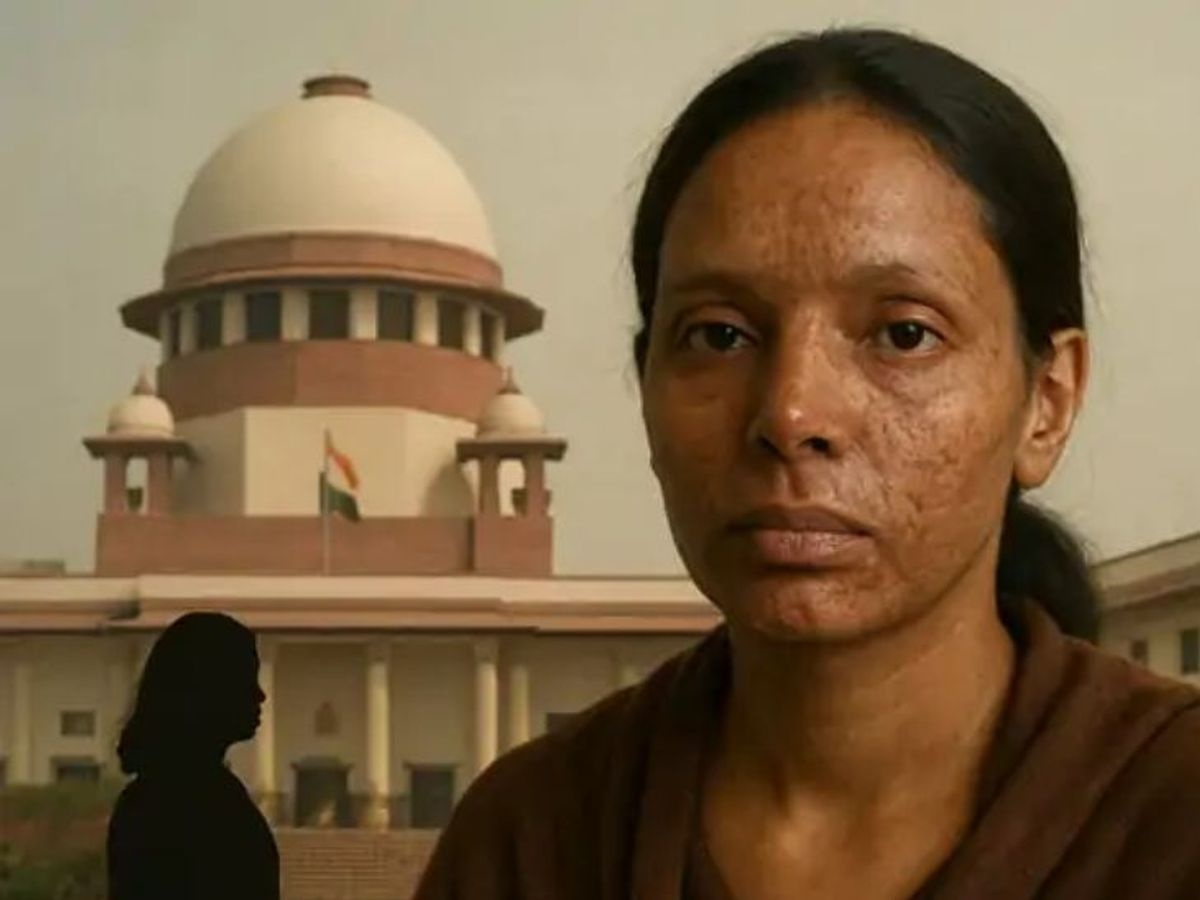 एसिड अटैक मामलों पर सुप्रीम कोर्ट बोला- केंद्र सख्त कानून बनाए, संपत्ति नीलाम कर पीड़िता को मुआवजा दे