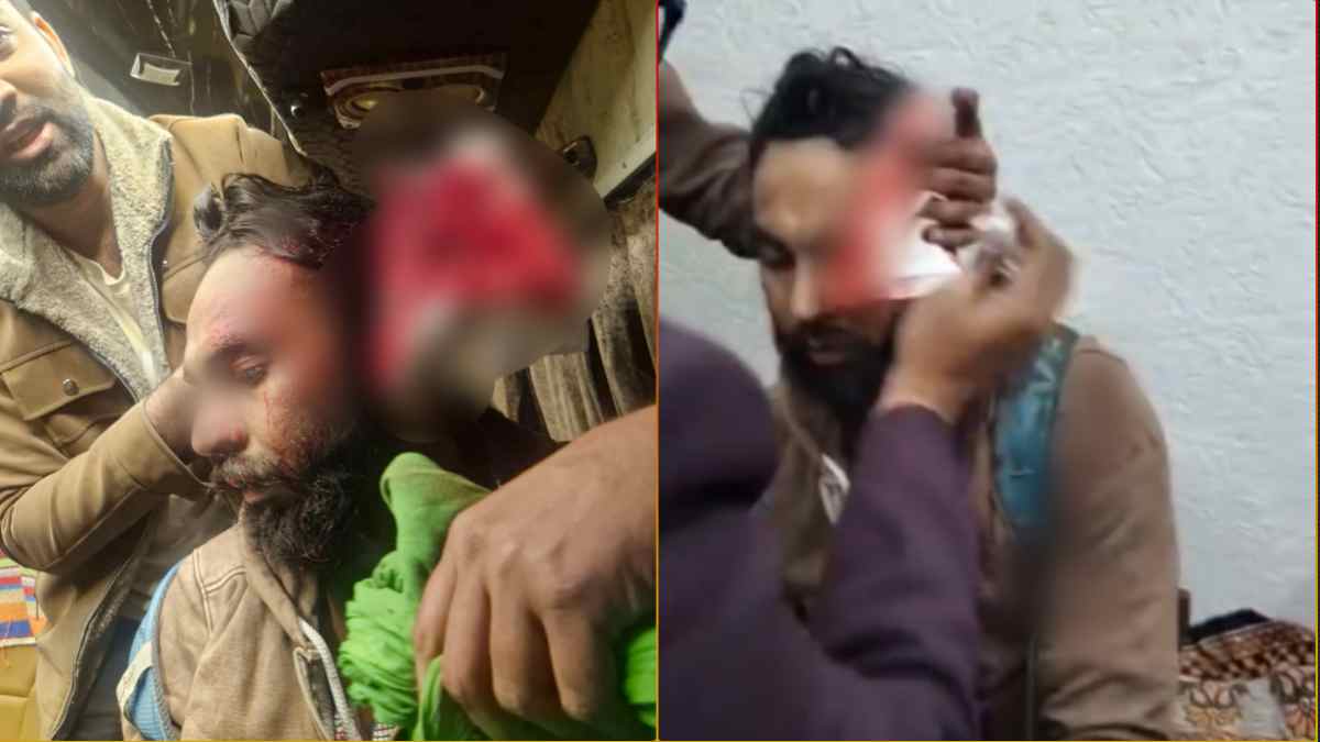 हिल स्टेशन में बवाल: खराब सर्विस की शिकायत करना टूरिस्ट को पड़ा भारी, एडवेंचर कंपनी के मालिक ने फोड़ा सिर