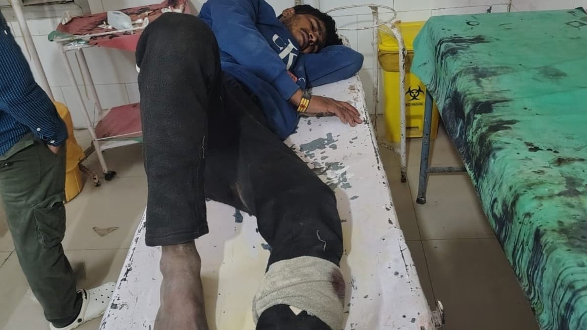 STF की गोली से अपराधी हुआ घायल, अस्पताल में चल रहा इलाज, सूर्या के ऊपर दर्ज है दर्जनों मामले