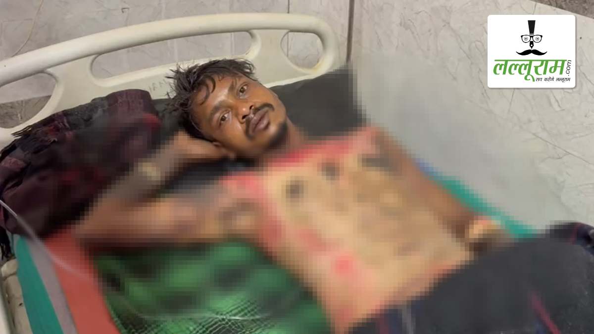 प्रेमिका से मिलने आए युवक की हत्या की कोशिश: भाई ने पेट्रोल डालकर किया आग के हवाले, गंभीर हालत में अस्पताल में कराया गया भर्ती