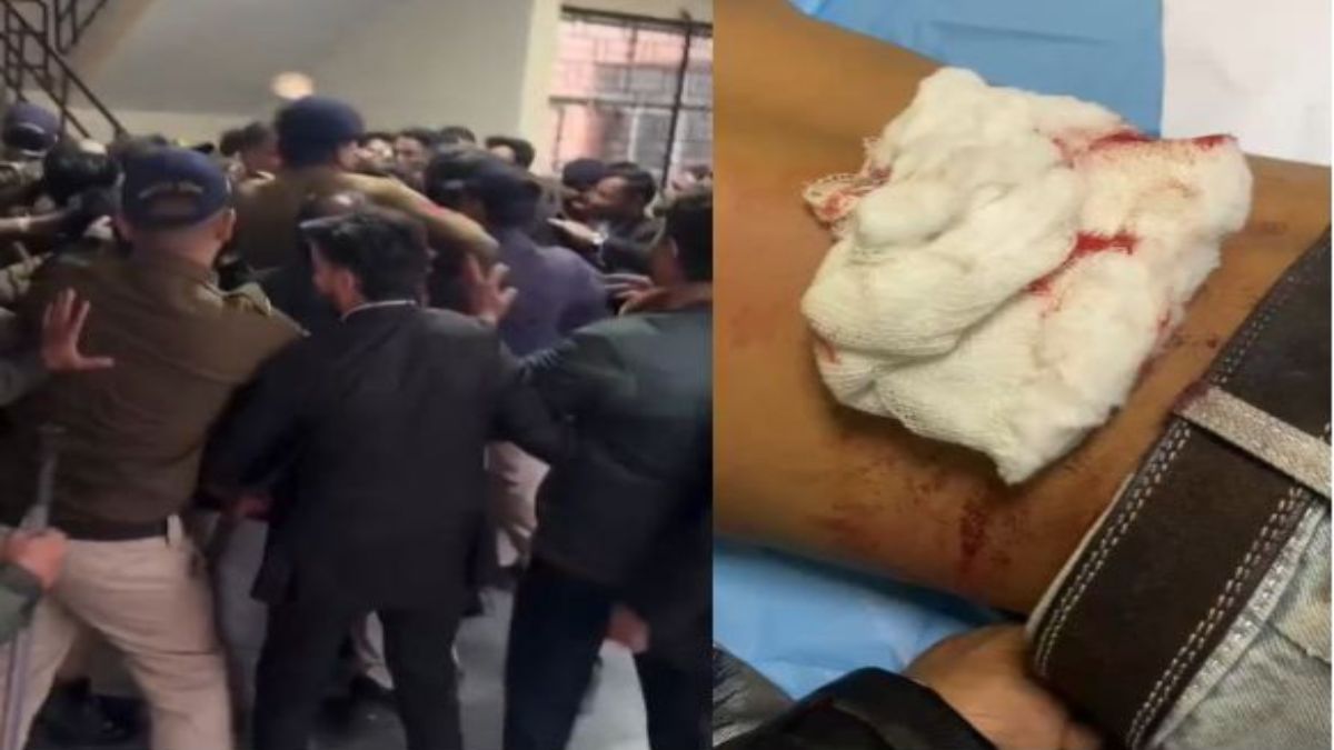 Bhopal Crime News: दुष्कर्म के आरोपी की कोर्ट में पेशी के दौरान वकीलों ने कर दी पिटाई, इधर कमला पार्क में बैठे युवक पर चाकू से हमला, पीठ और पंजे में आई चोट