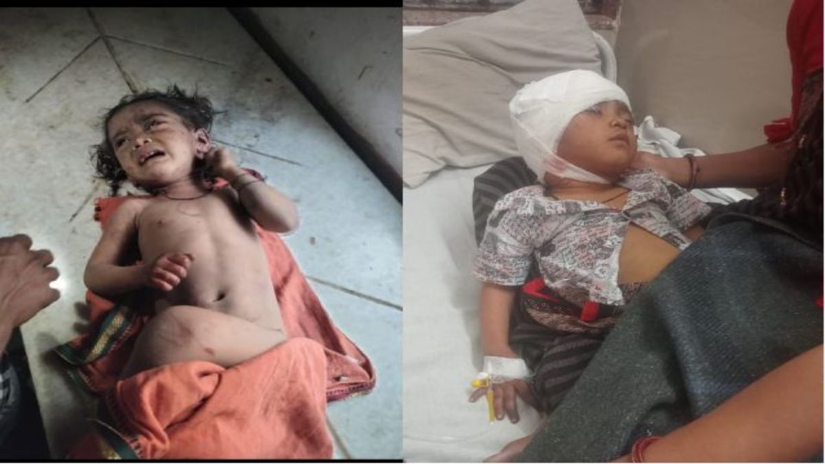 मासूम बनी आवारा कुत्तों का शिकारः डेढ़ साल की बच्ची पर कुत्तों के झुंड ने बोला हमला, नोचते ले गए, लहुलूहान हालत में मिली