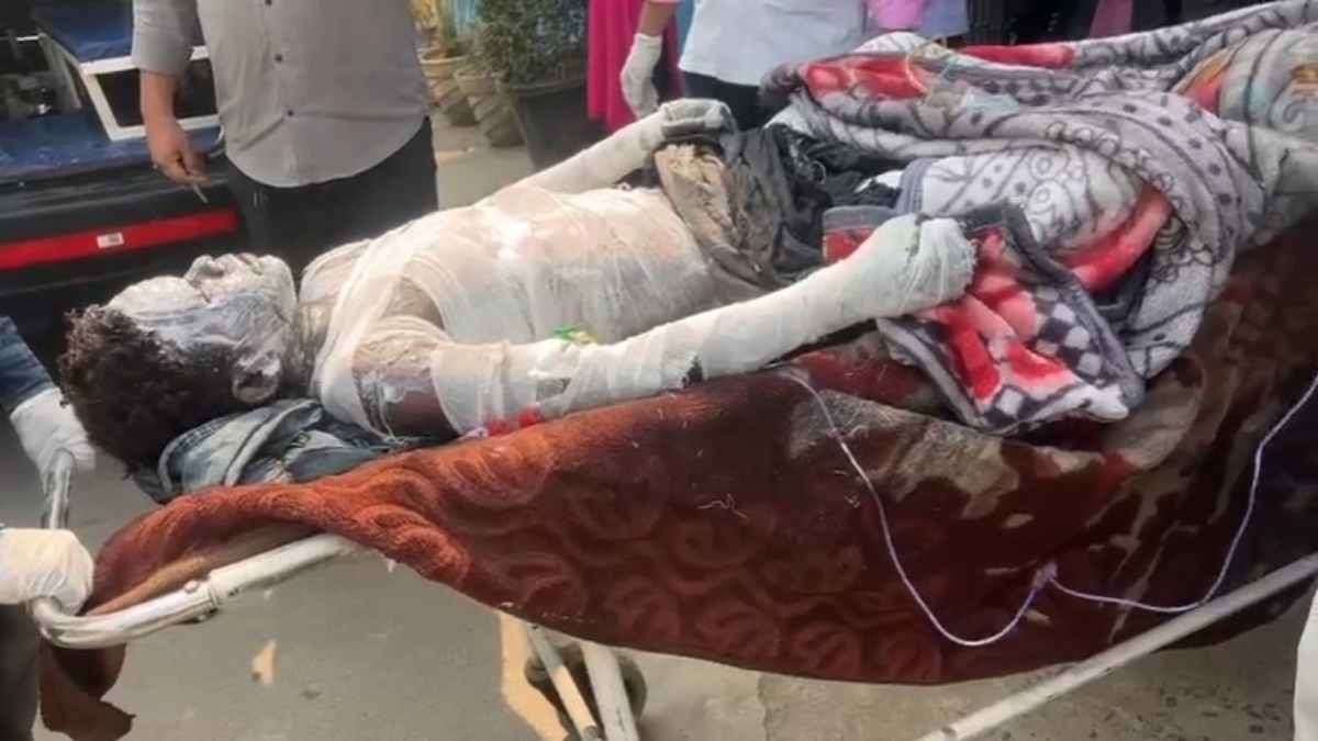 कार्बन प्लांट ब्लास्ट मामला: बिना सुरक्षा उपकरण कराया जा रहा था काम, कंपनी प्रबंधकों के खिलाफ FIR दर्ज