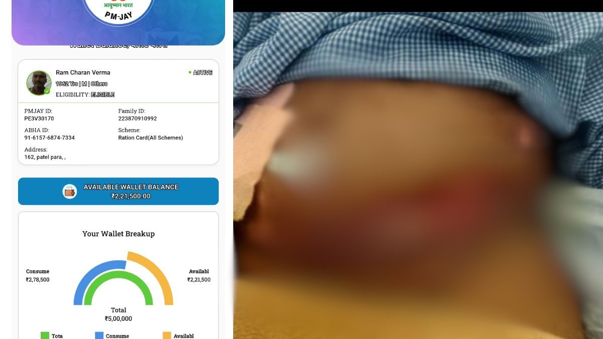 मरीज की जान से खिलवाड़! पेट दर्द की शिकायत पर आयुष्मान कार्ड से 2.71 लाख का इलाज, फिर थमाया 15 लाख का बिल, परिजनों ने उर्मिला मेमोरियल हॉस्पिटल पर लगाया गंभीर आरोप