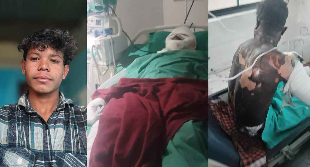 खरसिया औद्योगिक हादसा : 9 माह की मासूम के बाद पिता और युवक की भी मौत, परिवार पर टूटा दुखों का पहाड़, घटना की निष्पक्ष जांच और सख्त कार्रवाई की मांग