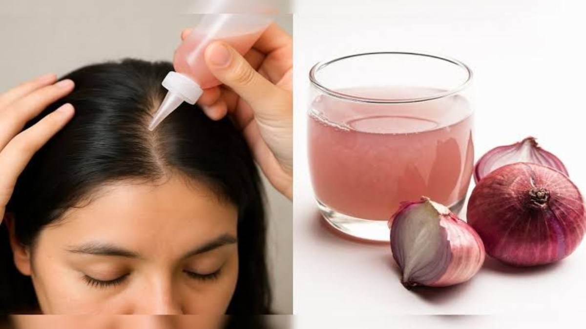 आप भी अपने बेजान बालों से हैं परेशान? तो इस तरह से करें प्याज का इस्तेमाल …