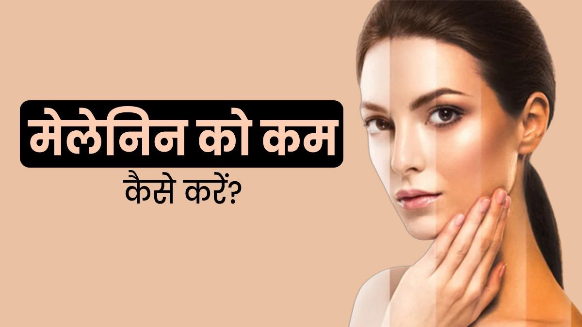 मेलानिन को आप भी करना चाहते हैं कंट्रोल, तो कर सकते हैं ये काम …