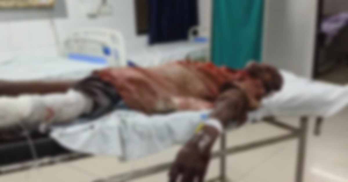 ‘मौत’ घूम रही, जरा संभलकर रहना! जंगली सुअरों का आतंक, 2 लोगों पर हमला कर किया गंभीर घायल, आखिर कहां खाक छान रहे जिम्मेदार?