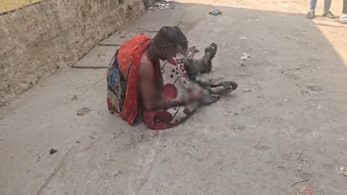 CG News : युवक ने खुद को आग लगाकर की आत्महत्या की कोशिश, पुलिस की तत्परता से बची जान