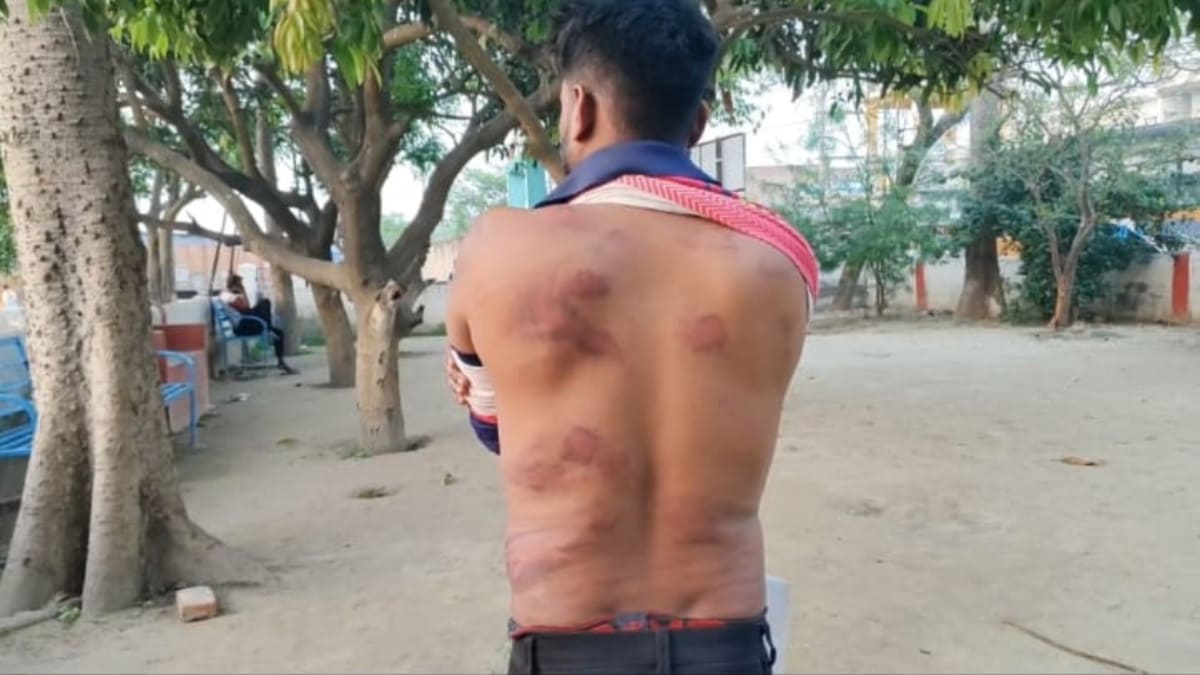 छठ घाट से लौट रहे युवक को कार में खींचकर लोहे की रॉड से पीटा, हालत गंभीर