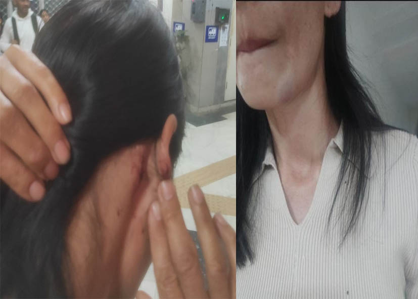 दिल्ली में मणिपुर की महिला और उसके दोस्तों से मारपीट, मेघालय CM ने जताई नाराजगी; पुलिस ने दिया जवाब