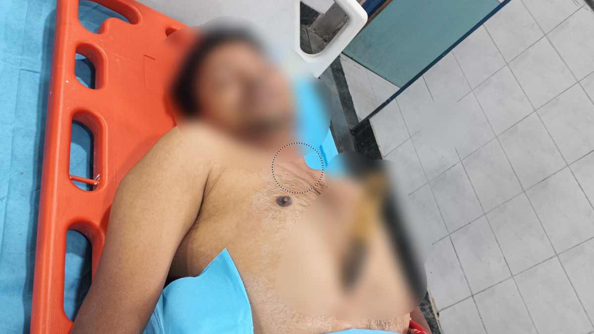 किराए मांगने पर ई-ऑटो चालक पर जानलेवा हमला, सीने में फंसा बर्फ तोड़ने वाला सूजा; हालत गंभीर