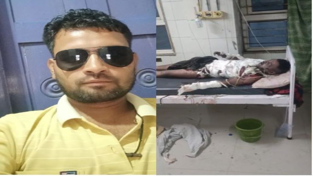 दिल दहलाने वाली घटनाः पेट्रोल डालकर युवक को जिंदा जलाया, मेडिकल कॉलेज में तोड़ा दम, ये रही वजह