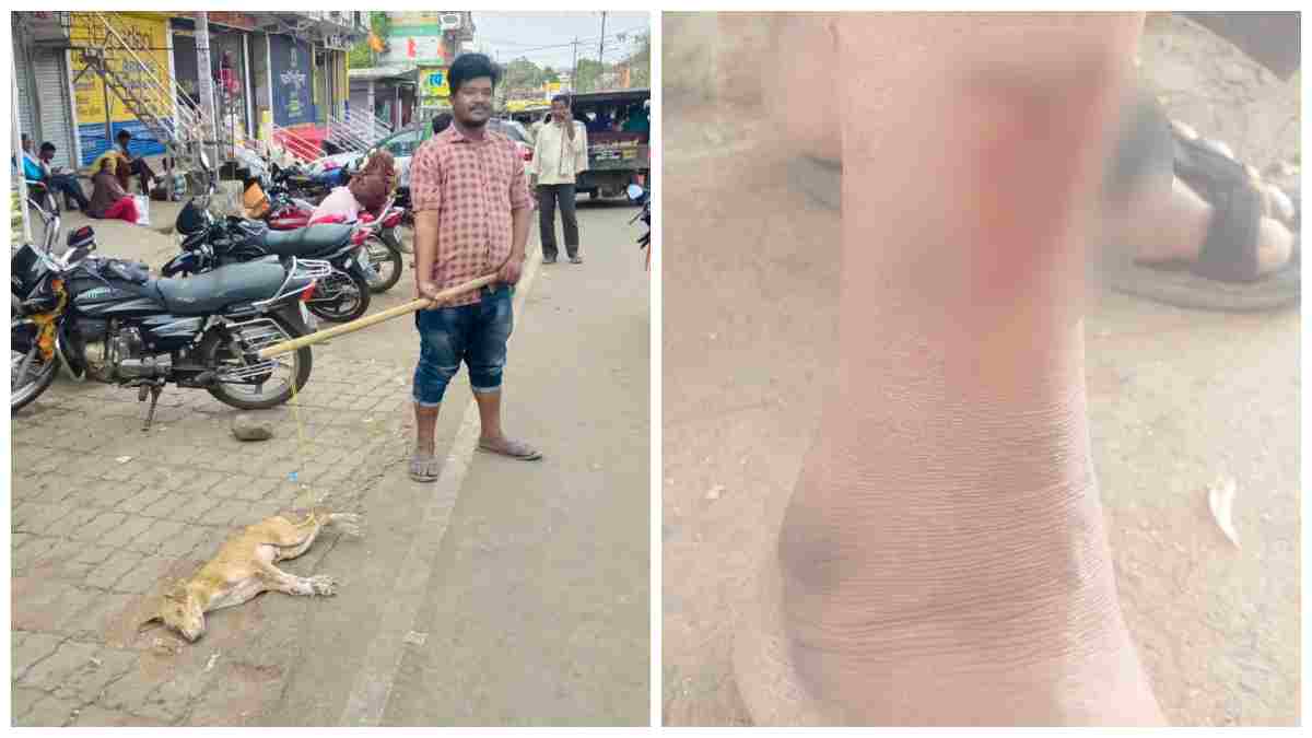 अमरवाड़ा में पागल कुत्ते का आतंक: 6 लोगों को बुरी तरह काटा, 2 गंभीर घायल छिंदवाड़ा रेफर, मंडराया रेबीज का खतरा 