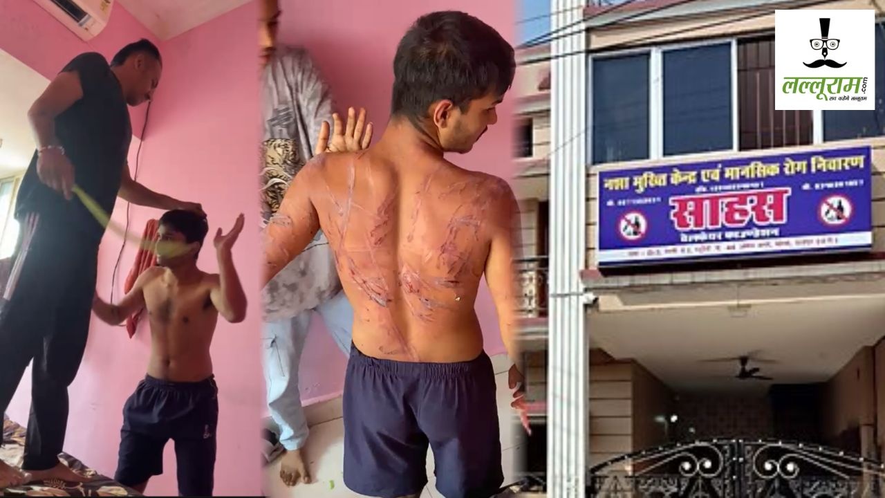 नशा मुक्ति केंद्र में आदिवासी युवक के साथ बर्बरता! लत छुड़ाने के नाम पर दिए गहरे जख्म, संचालिका के बेटे पर FIR दर्ज