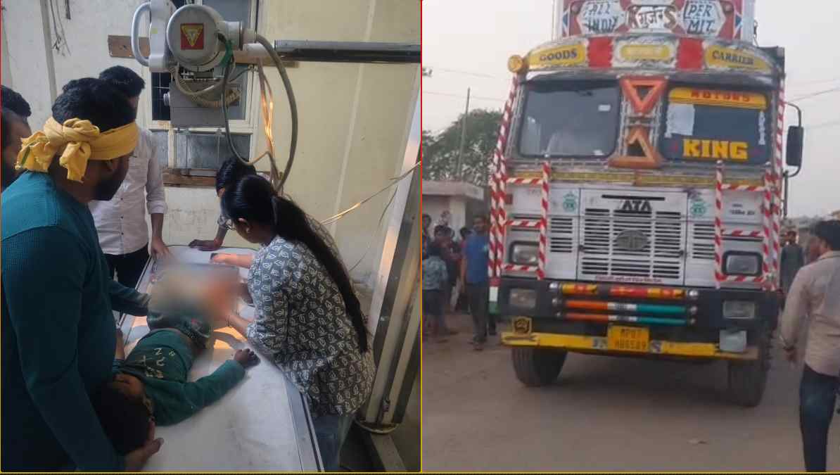 बस्ती में तेज रफ्तार ट्रक का कहर: घर के बाहर खेल रहे 5 साल के मासूम को रौंदा, फिर रिवर्स कर कुचल दिए दोनों पैर