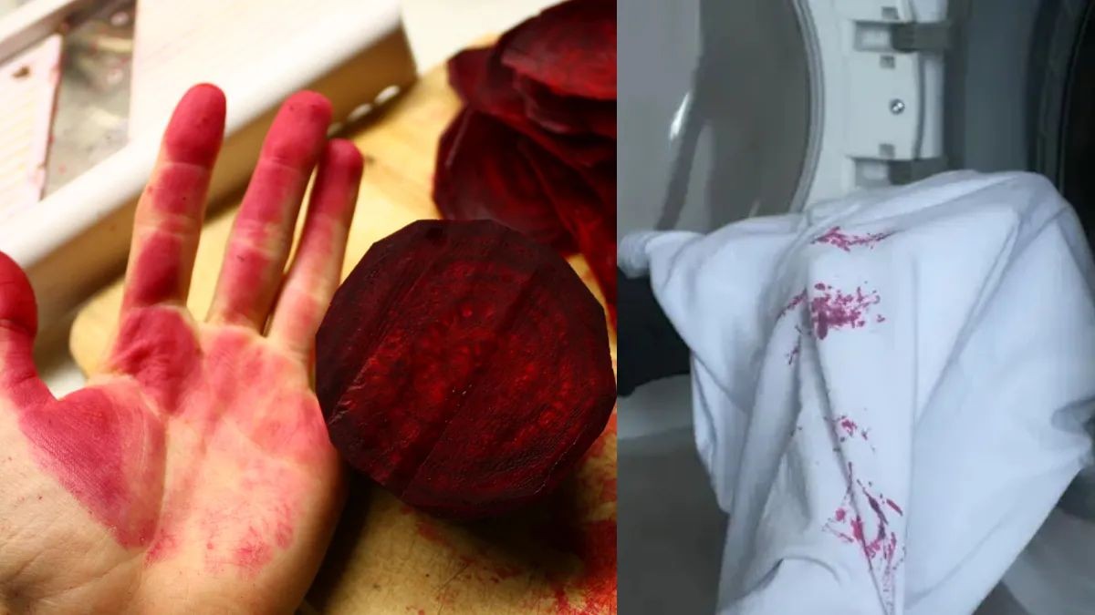 कपड़े और हाथ में लग गया है चुकंदर का दाग, तो इस तरह से चुटकियों में होंगे साफ …