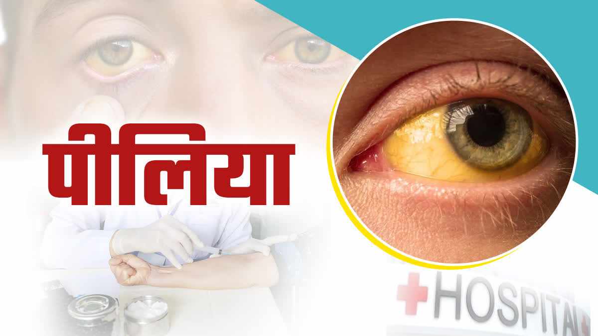 पंजाब में पीलिया का कहर: फिरोजपुर के गांव में 19 वर्षीय युवक की मौत, बैक्टीरिया संक्रमण से दहशत
