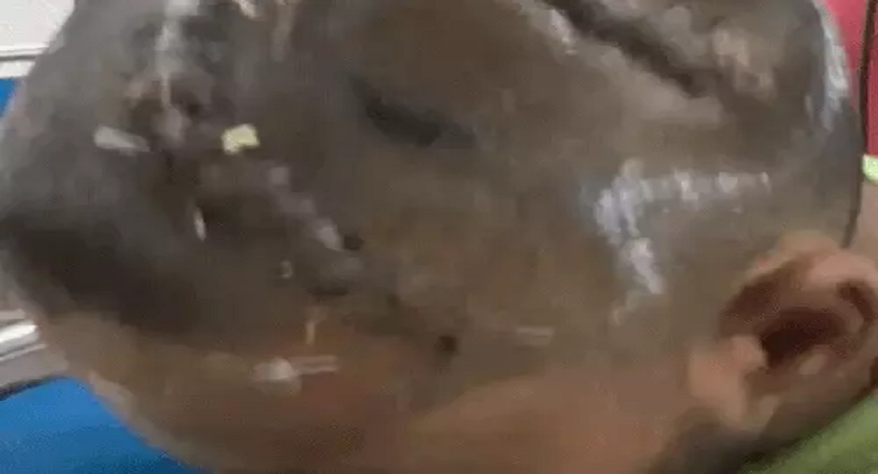 सिर की हड्डी टूटकर दिमाग में घुसी: सिरसा में लोहे के गेट के विवाद पर खूनी खेल, जिंदगी और मौत से जूझ रहा युवक