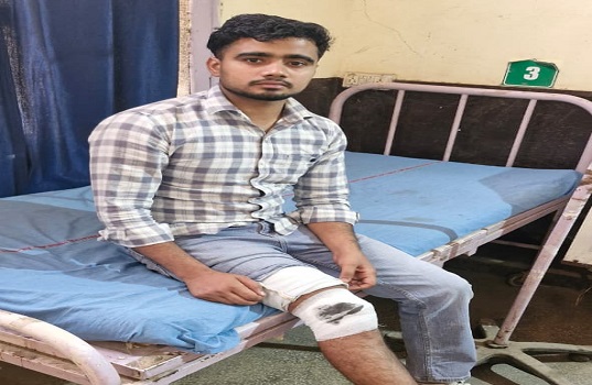 नूंह में मुठभेड़: हिस्ट्रीशीटर के पैर में लगी गोली, पुलिस टीम पर फायरिंग कर भागने की कोशिश