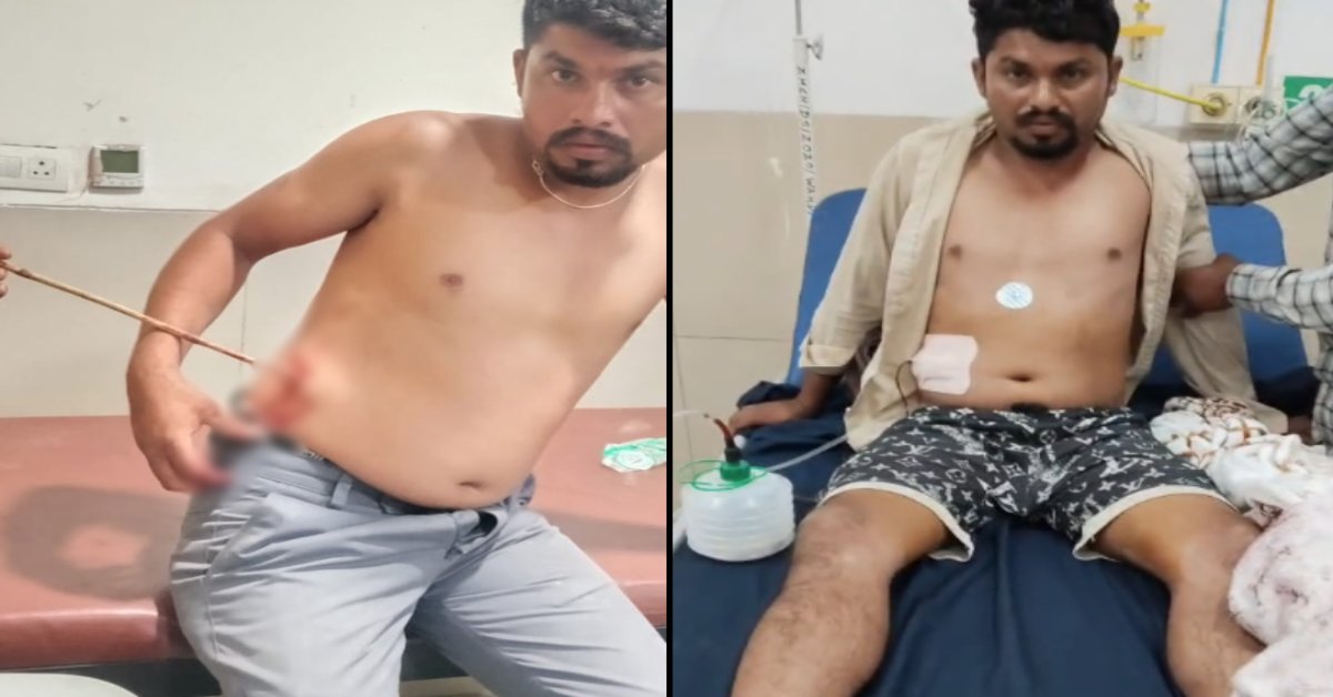 आलीराजपुर में शादी में खूनी संघर्ष: काका ने भतीजे पर चलाया तीर, पेट के अंदर घुसा; गुजरात रेफर