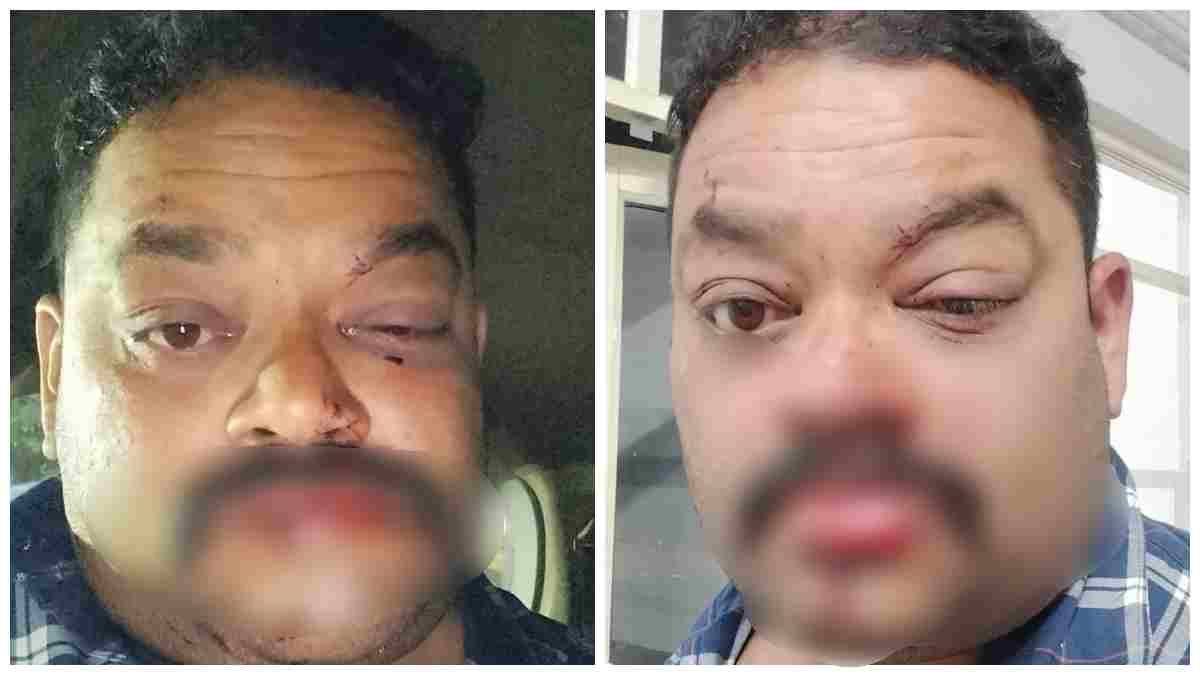 मस्जिद के बाहर युवक पर जानलेवा हमला: नकाबपोश बदमाशों ने चाकुओं से गोदा, हालत गंभीर  