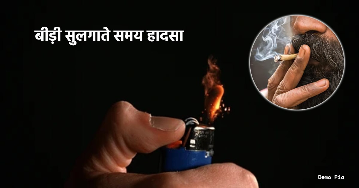 आग में जिंदा जला बुजुर्ग: लाइटर से बीड़ी जला रहा था वृद्ध, अचानक भड़क उठी चिंगारी