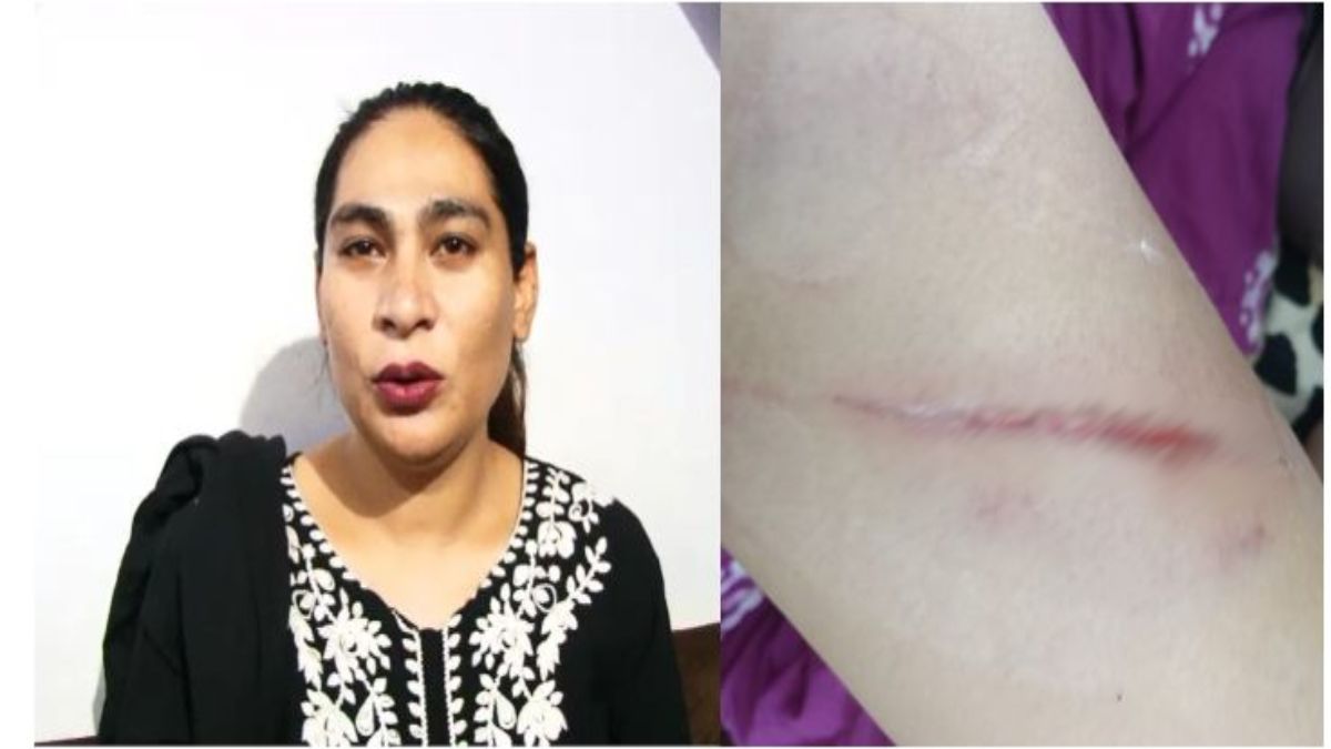 बदमाशों ने राह चलते किन्नर पर किया हमलाः 2 अलग अलग इलाकों में मारपीट की घटना, किन्नरों ने दी ये चेतावनी