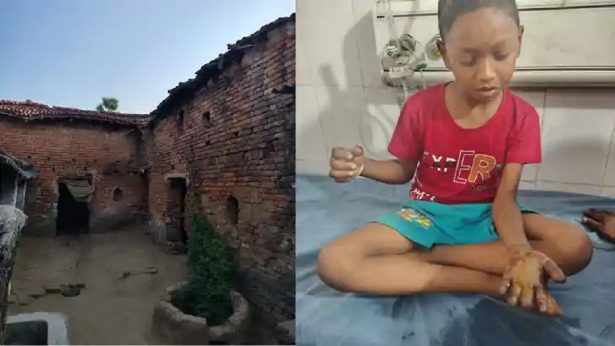 नवादा: पड़ोसी के घर खेलने गए बच्चे के हाथ में फटा बम, विरोध करने पर मिली जान से मारने की धमकी