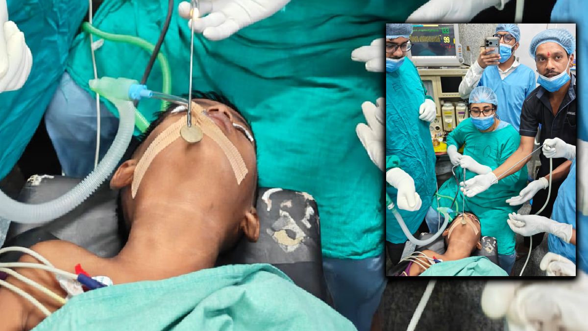 5 साल के मासूम के गले में फंसा सिक्का, सिम्स के डॉक्टरों ने एंडोस्कोपिक तकनीक से बचाई जान