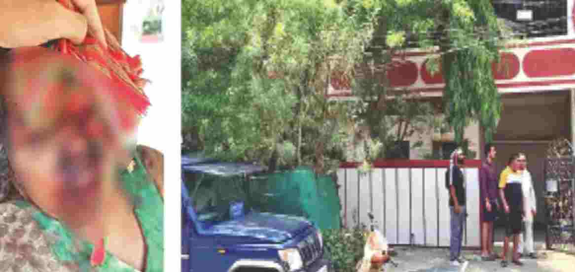 भोपाल में दिनदहाड़े लूट: मजदूर ने बुजुर्ग महिला को बंधक बनाकर वारदात को दिया अंजाम, पुलिस ने जारी की एडवाइजरी