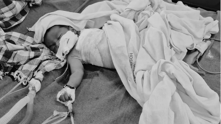 Ajmer में कलेजा चीर देने वाली घटना: कुत्तों के हमले में घायल मासूम ने तोड़ा दम, पेट में गहरे घाव देख डॉक्टरों की भी कांप गई रूह