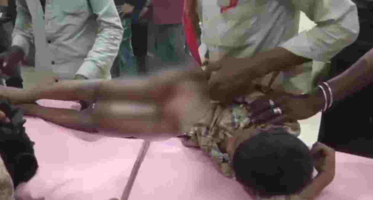 आफत में फंसी जान: मासूम के प्राइवेट पार्ट में घुसा सरिया, डॉक्टर्स ने ऑपरेशन कर दी नई जिंदगी