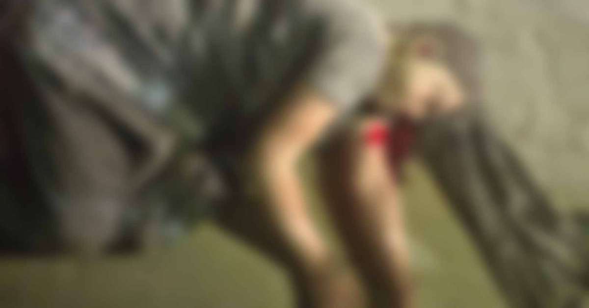 मौत बांट रहा योगी सरकार का सिस्टम! भाई-बहन हुए भीषण सड़क हादसे का शिकार, एक की मौत, दूसरा लड़ रहा जिंदगी की जंग