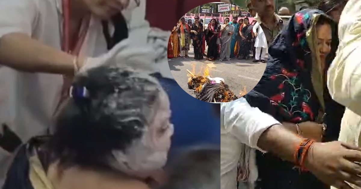 राहुल और अखिलेश का पुतला जलाने गईं पूर्व मंत्री खुद झुलसी, नारी वंदन अधिनियम को लेकर हो रहा था विरोध