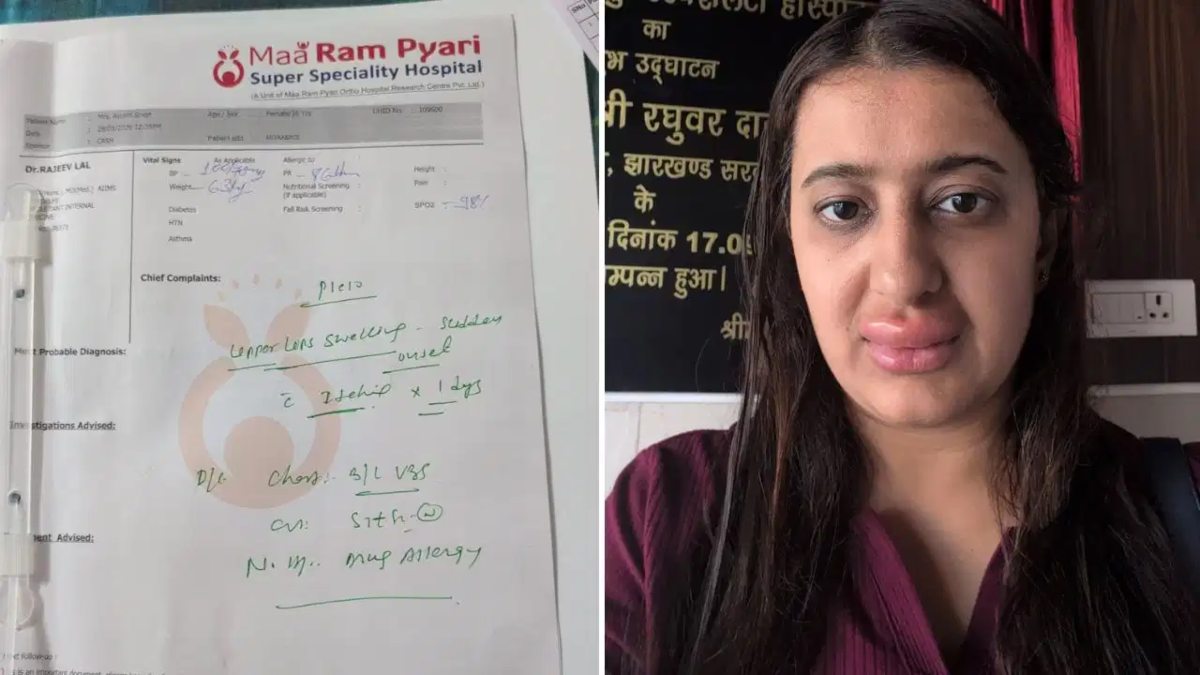 मां-बेटे ने खाया वंदे भारत एक्सप्रेस का खाना, महिला के सूजे होंठ; बेटे की स्थिति हुई गंभीर, IRCTC का जवाब- हमारा खाना बिल्कुल सुरक्षित