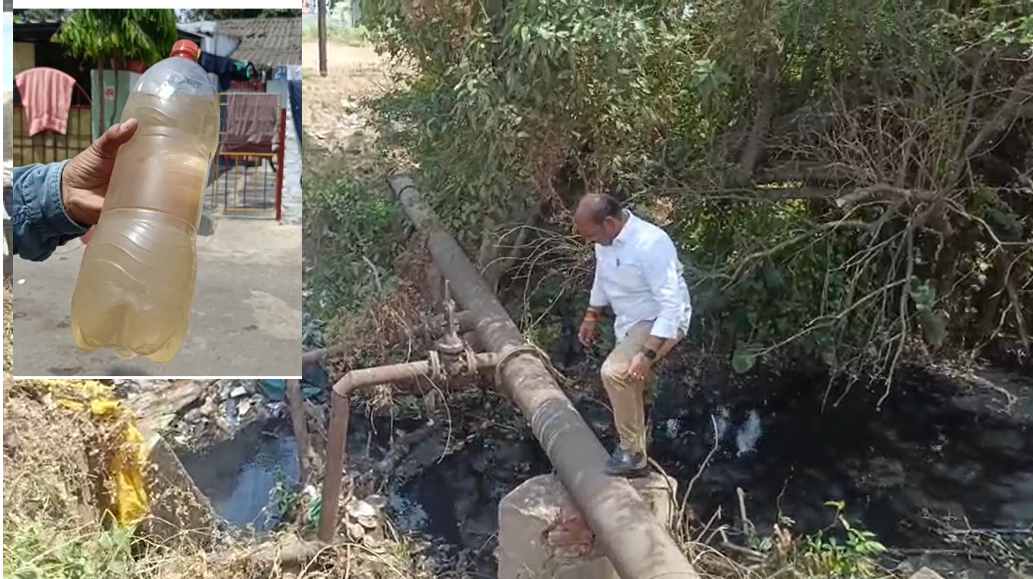 भिलाई के सेक्टर-7 में पीलिया का कहर : दो दिनों से नलों में आ रहा गंदा पानी, 35 से ज्यादा बच्चे बीमार