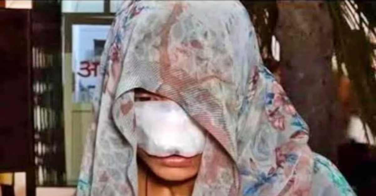नाक काटी, गाल चबाया और… पति ने पार की हैवानियत की हदें, घरेलू विवाद में पत्नी का किया ऐसा हाल, जानकर सहम जाएगा दिल
