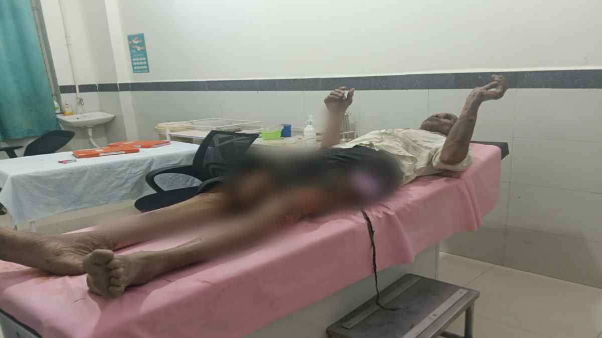 इछावर में बड़ा हादसा: हार्डवेयर दुकान में पूजा के दौरान भड़की आग, मालिक झुलसा, दुकान खाक