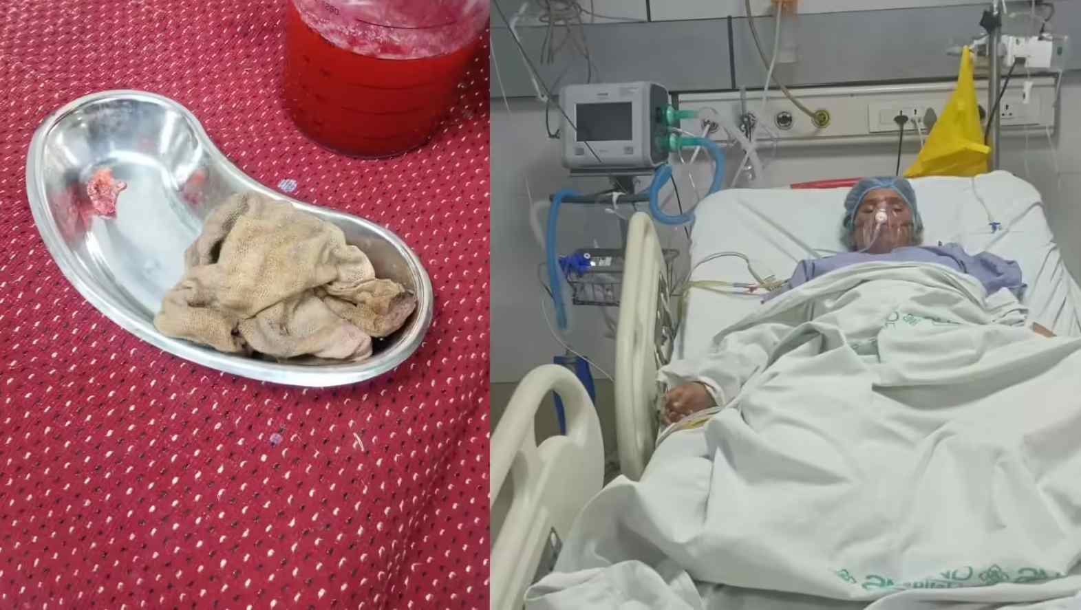 MP में जानलेवा इलाज: गर्भवती की सर्जरी के बाद पेट के अंदर नेपकिन भूल गए डॉक्टर, दर्द उठा तो बनाया अनोखा बहाना