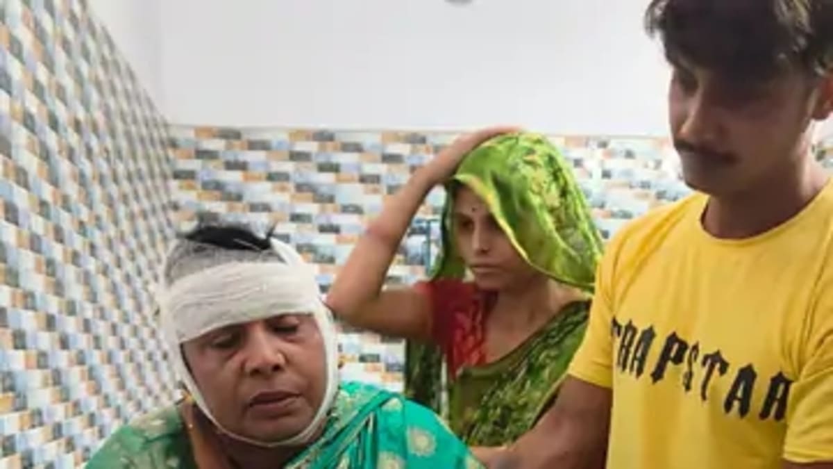 जन्मदिन में जा रही महिला से दिनदहाड़े सोने की चेन की लूट, सिर फटने से हुई बेहोश