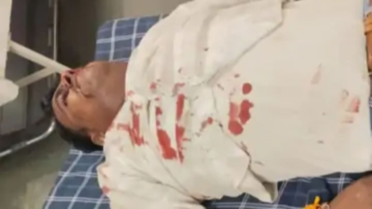 भीषण सड़क हादसा में दो बाइकों की सीधी भिड़ंत, दो युवक गंभीर रूप से घायल, एक बाइक सवार फरार, जांच जारी